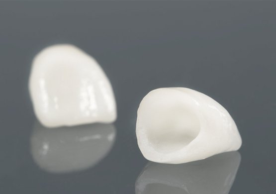 Smile-Designers-olokeramikes_stefanes