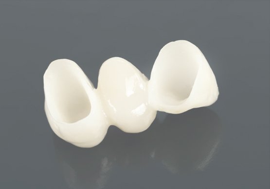 Smile-Designers-olokeramikes_stefanes_3